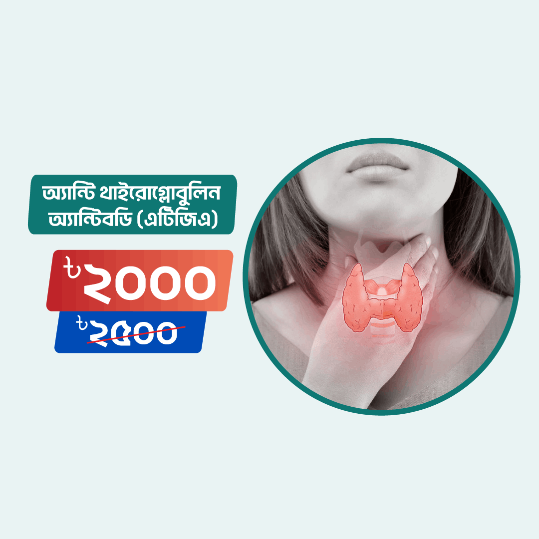 Anti Thyroglobulin Antibody (ATGA) Arogga Online Lab