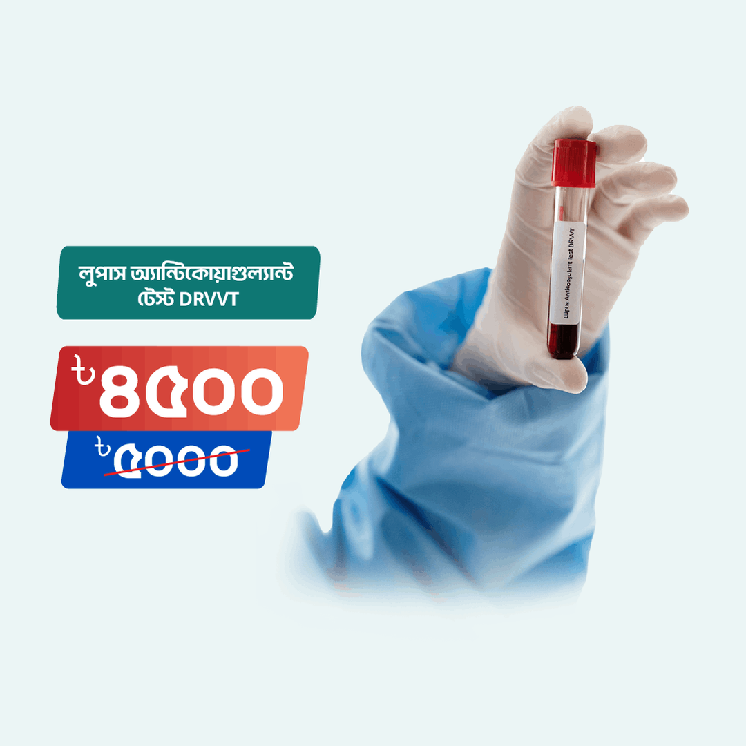 Lupus anticoagulant test drvvt arogga online lab