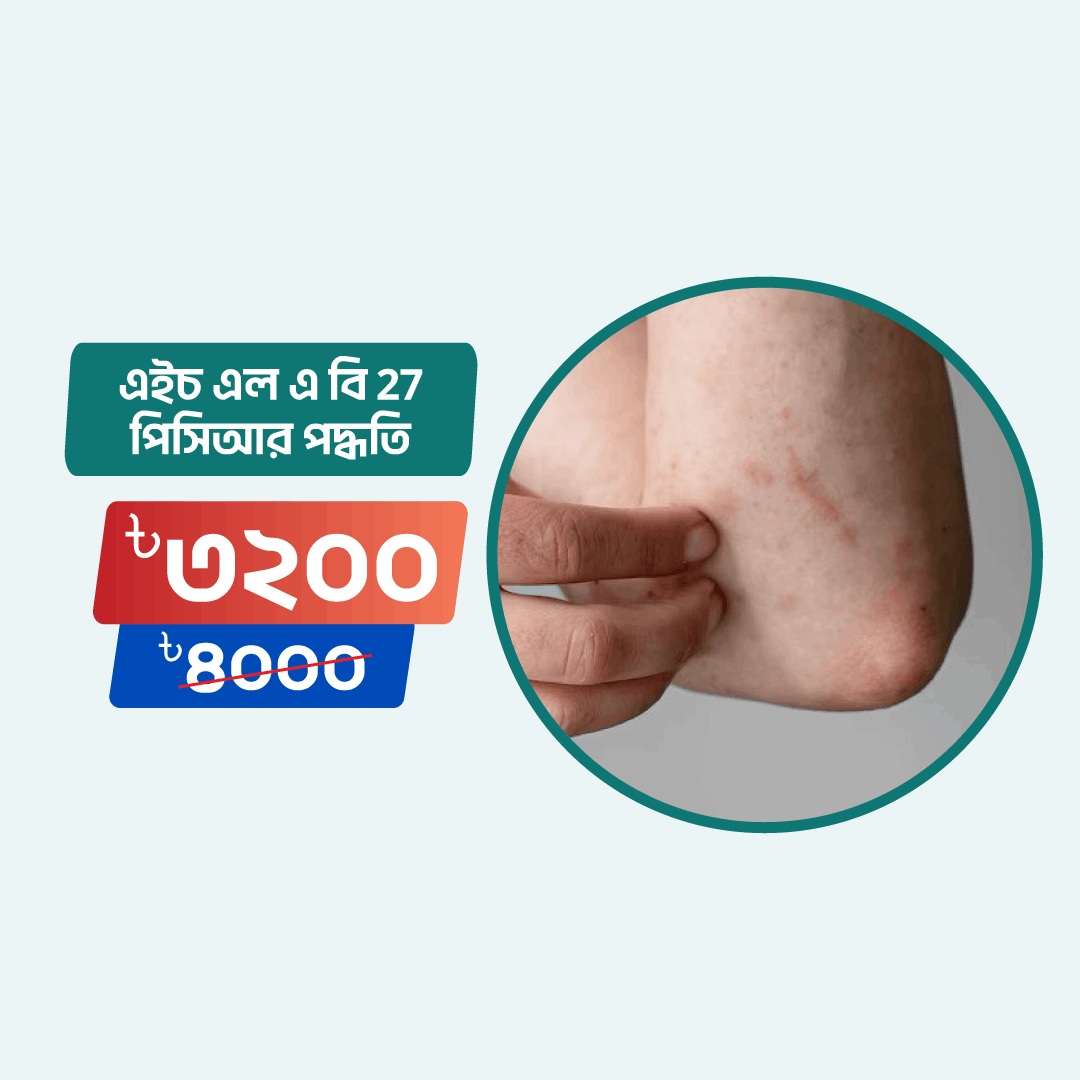 Hla B27 Pcr Method - Arogga Online Lab