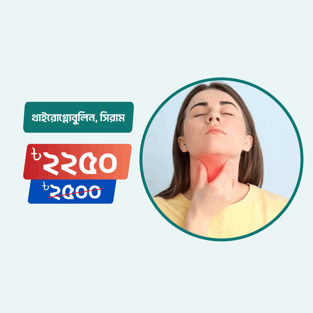 Thyroglobulin, serum Arogga Online Lab