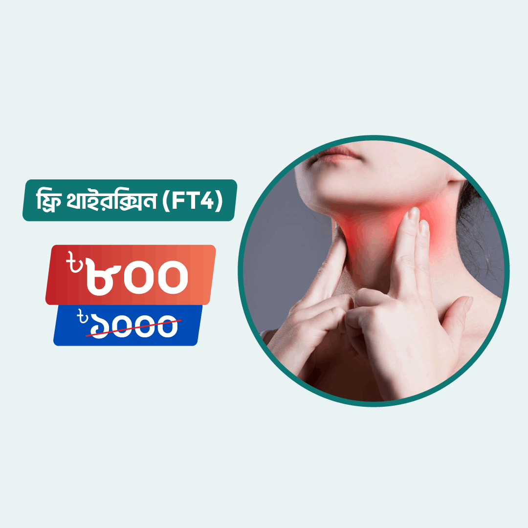 Free Thyroxine (FT4) Arogga Online Lab