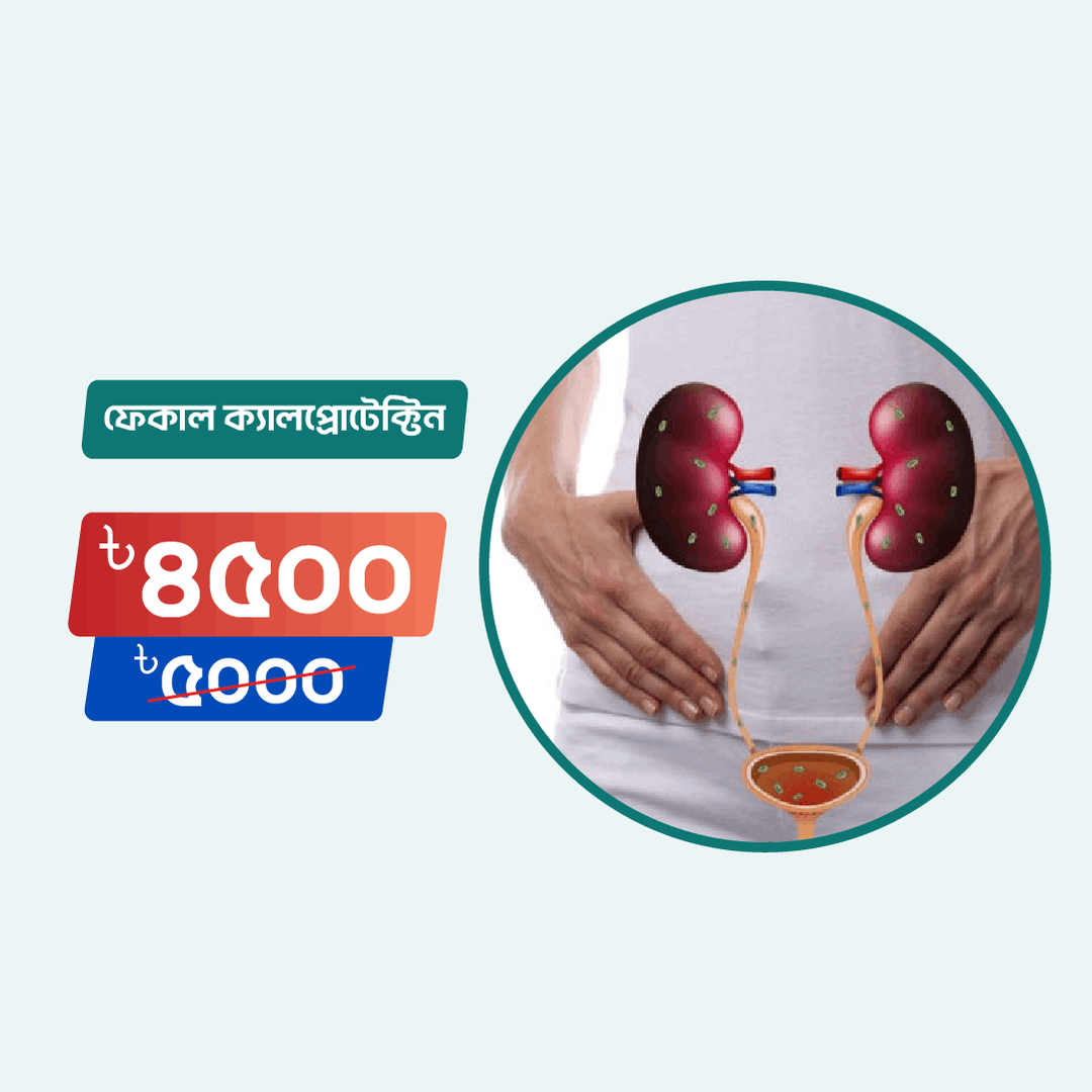 Fecal Calprotectin Arogga Online Lab