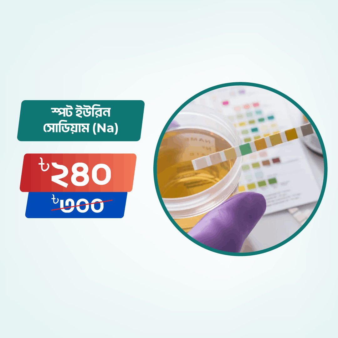 Spot Urine Sodium (Na) Arogga Online Lab