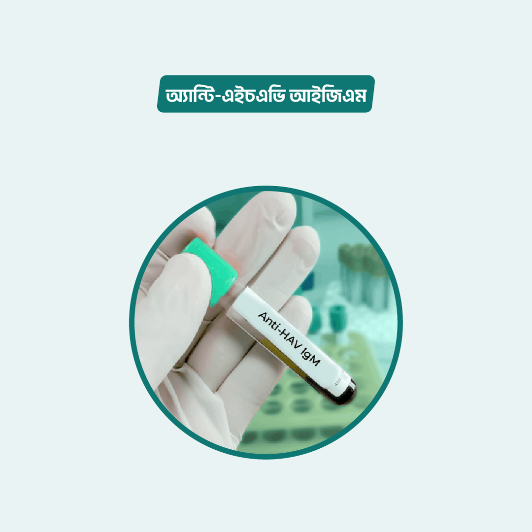 Book Anti HAV - (IgM) Lab test Online from Home - Arogga