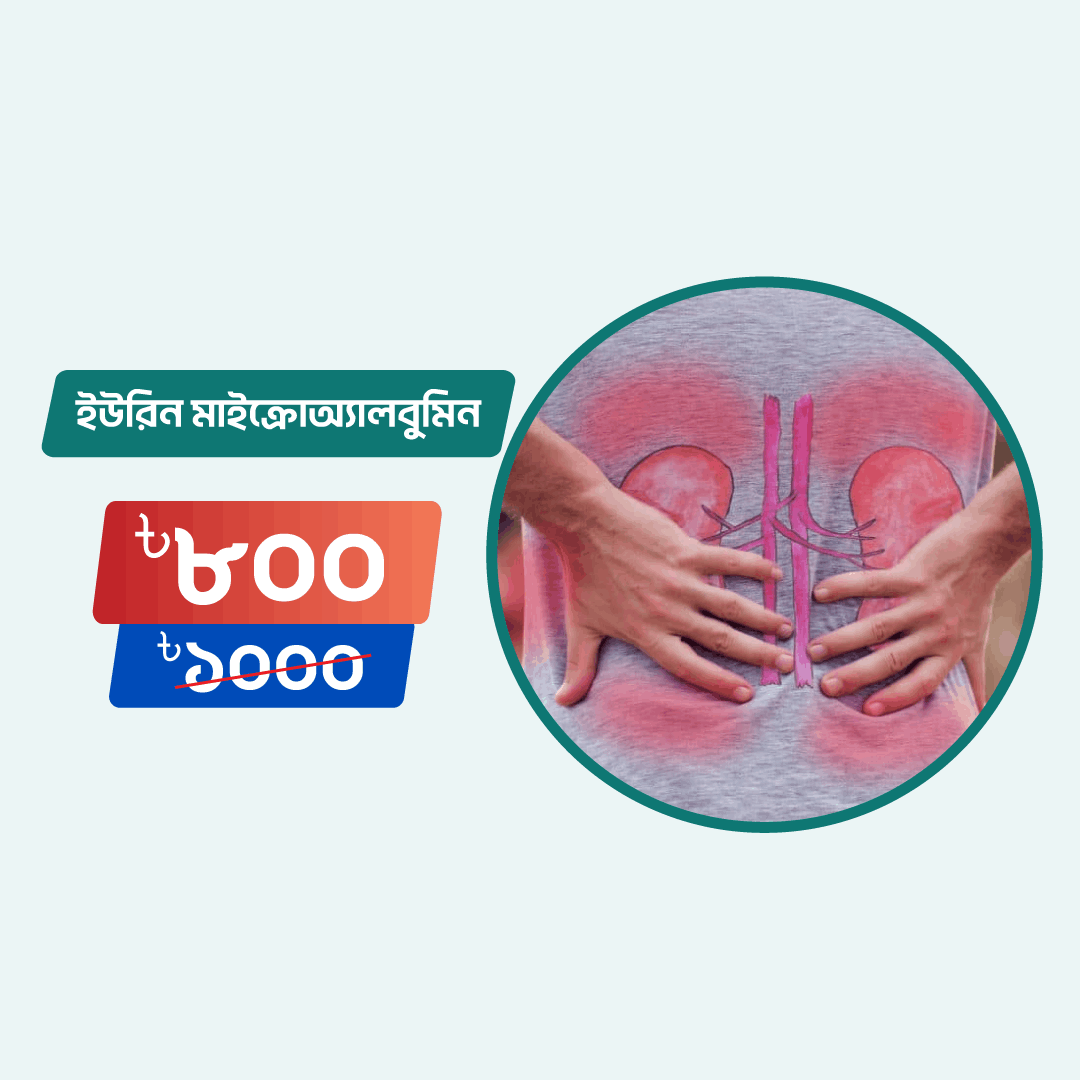 Urine Microalbumin Arogga Online Lab