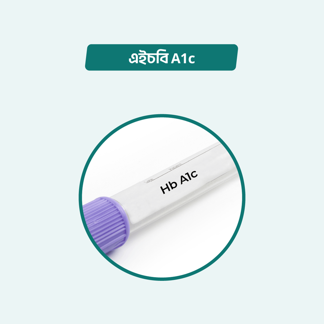 HbA1c - Arogga Online Lab