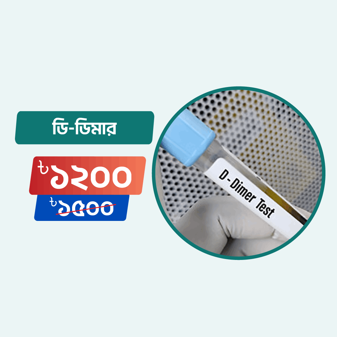 D dimer arogga online lab