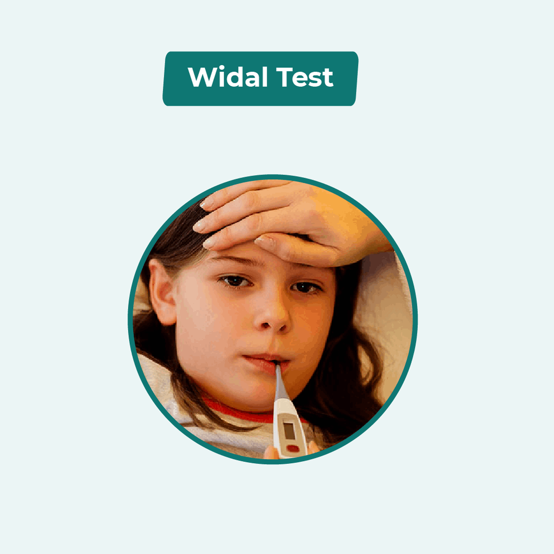 Book Widal Test Lab test Online from Home - Arogga