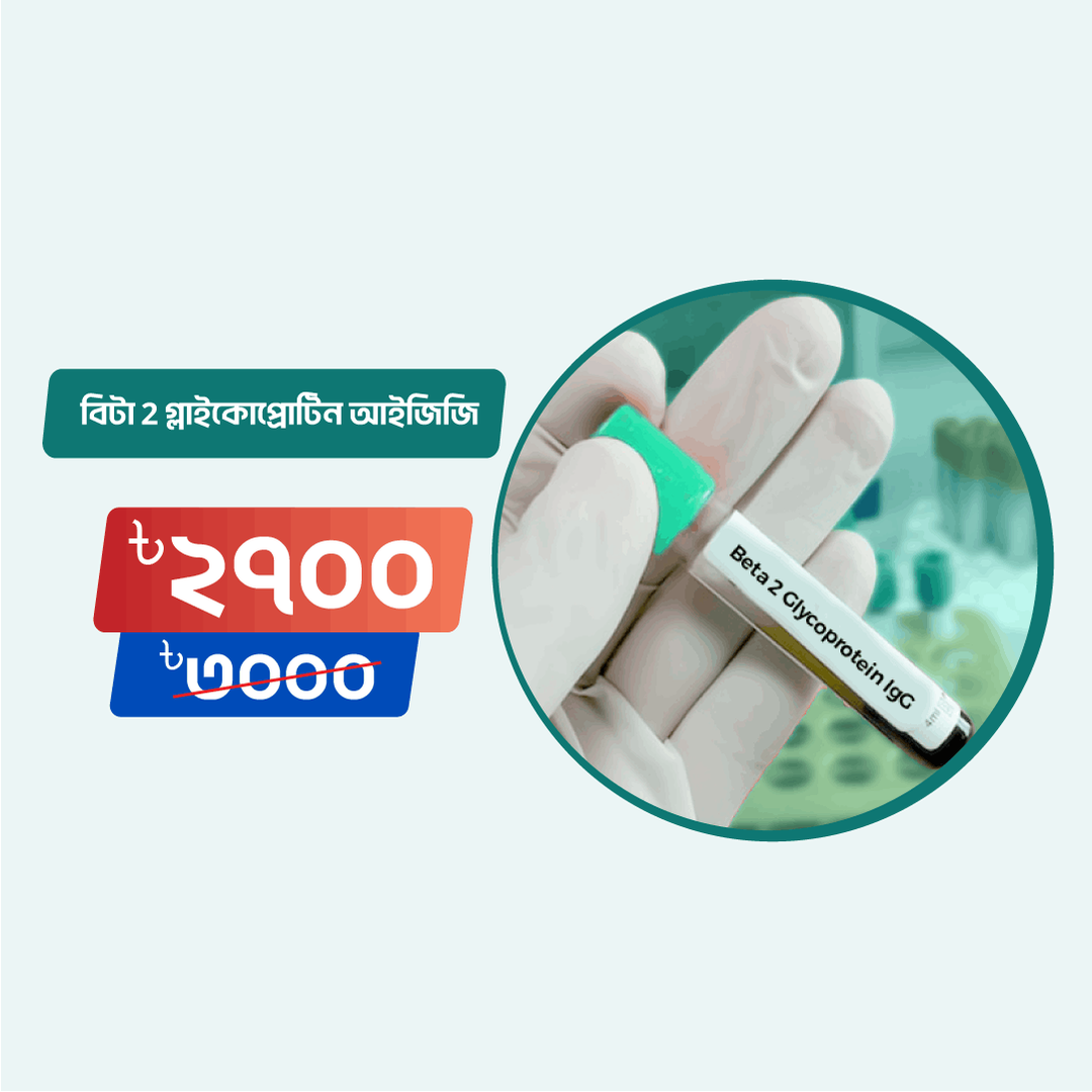 Beta 2 Glycoprotein IgG - Arogga Online Lab