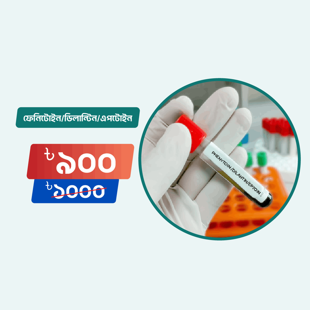 Phenytoin /Dilantin/Eptoin - Arogga Online Lab