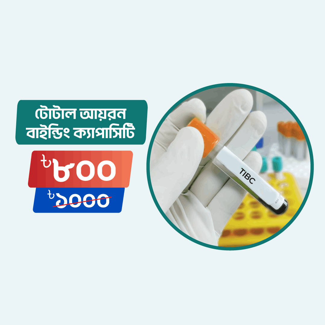 Total Iron Binding Capacity (TIBC) Arogga Online Lab