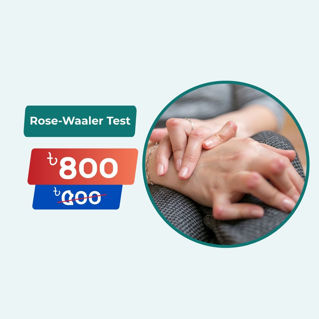 Rose-Waaler Test - Arogga Online Lab